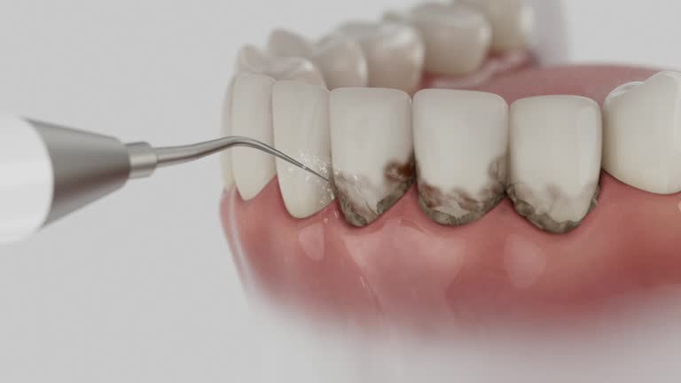 Trusted Teeth Cleaning And Checkup service in Corunna, MI - Dentist Open Now